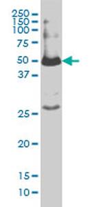 SMAD1 Antibody in Western Blot (WB)