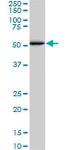 SMAD1 Antibody in Western Blot (WB)