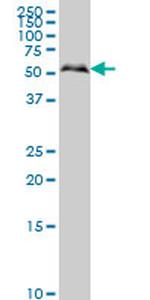 SMAD1 Antibody in Western Blot (WB)