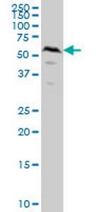 SMAD1 Antibody in Western Blot (WB)