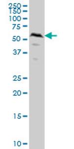 SMAD1 Antibody in Western Blot (WB)