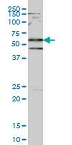 SMAD2 Antibody in Western Blot (WB)