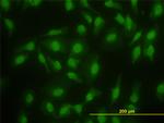 SMAD2 Antibody in Immunocytochemistry (ICC/IF)