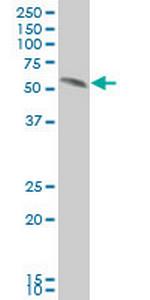 SMAD2 Antibody in Western Blot (WB)