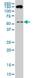 SMAD2 Antibody in Western Blot (WB)