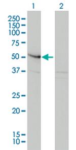 SMAD3 Antibody in Western Blot (WB)