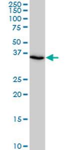 SMAD3 Antibody in Western Blot (WB)