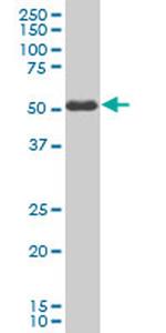 SMAD3 Antibody in Western Blot (WB)