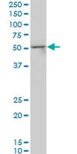 SMAD3 Antibody in Western Blot (WB)