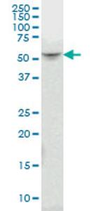 SMAD3 Antibody in Western Blot (WB)