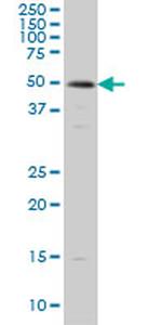 SMAD3 Antibody in Western Blot (WB)