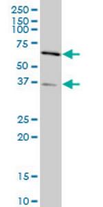 SMAD3 Antibody in Western Blot (WB)