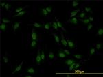 SMAD4 Antibody in Immunocytochemistry (ICC/IF)