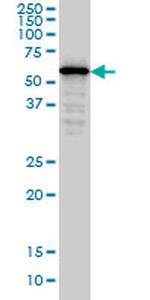 SMAD4 Antibody in Western Blot (WB)