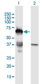 SMAD6 Antibody in Western Blot (WB)