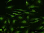 SMAD6 Antibody in Immunocytochemistry (ICC/IF)