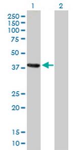 MAGEA4 Antibody in Western Blot (WB)