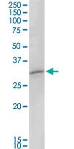 MAGEA8 Antibody in Western Blot (WB)