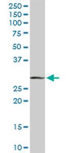 MAGEA9 Antibody in Western Blot (WB)