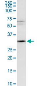 MAGEA9 Antibody in Western Blot (WB)