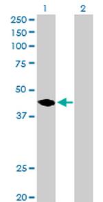 MAGEA11 Antibody in Western Blot (WB)