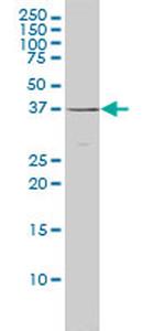 MAGEA11 Antibody in Western Blot (WB)