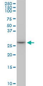 MAGEA12 Antibody in Western Blot (WB)