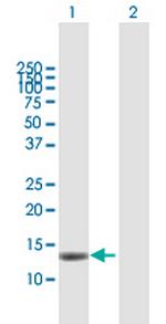 MAGOH Antibody in Western Blot (WB)