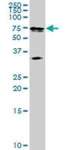 MAK Antibody in Western Blot (WB)