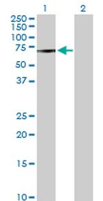 MAK Antibody in Western Blot (WB)