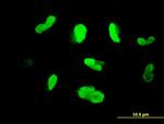 MAK Antibody in Immunocytochemistry (ICC/IF)