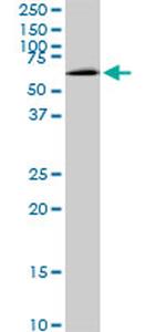 MAK Antibody in Western Blot (WB)