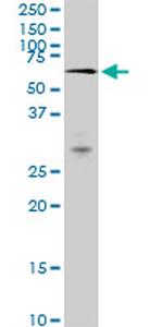 MAK Antibody in Western Blot (WB)