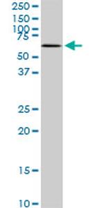 MAK Antibody in Western Blot (WB)