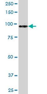 MATN2 Antibody in Western Blot (WB)