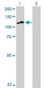 MATN2 Antibody in Western Blot (WB)