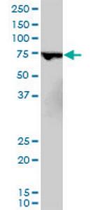 MBD1 Antibody in Western Blot (WB)