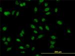 MBNL1 Antibody in Immunocytochemistry (ICC/IF)