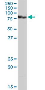 MCC Antibody in Western Blot (WB)