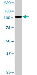 MCC Antibody in Western Blot (WB)