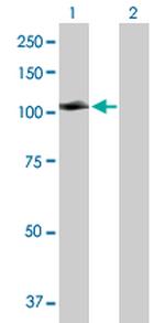 MCC Antibody in Western Blot (WB)