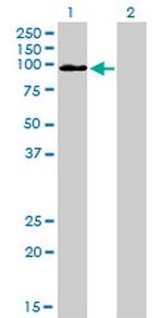 MCC Antibody in Western Blot (WB)