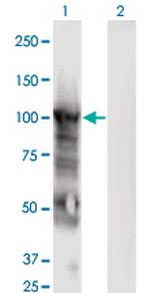 MCM6 Antibody in Western Blot (WB)