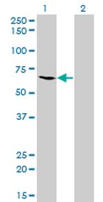 ME1 Antibody in Western Blot (WB)