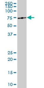 ME1 Antibody in Western Blot (WB)