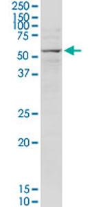 MECP2 Antibody in Western Blot (WB)