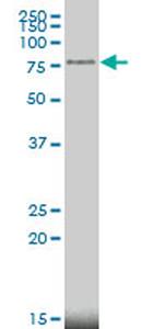 MECP2 Antibody in Western Blot (WB)