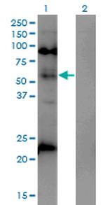 MECP2 Antibody in Western Blot (WB)