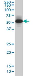 MEF2A Antibody in Western Blot (WB)