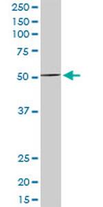 MEF2D Antibody in Western Blot (WB)